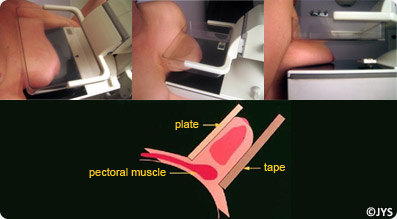 How does a mammogram work?